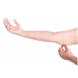aplicação de enzimas no braço