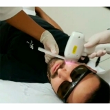 clínica de depilação a laser barba Jardim Santa Angela